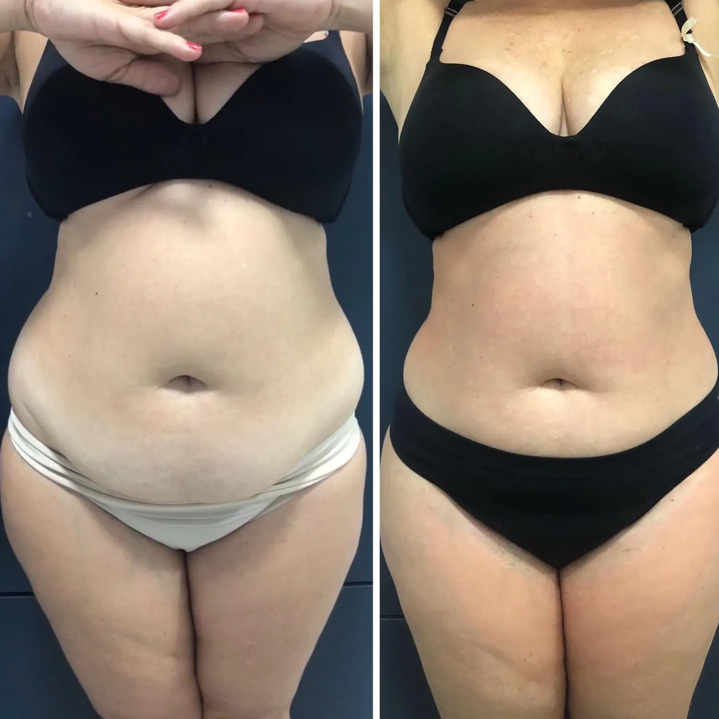 Antes e depois 1.webp