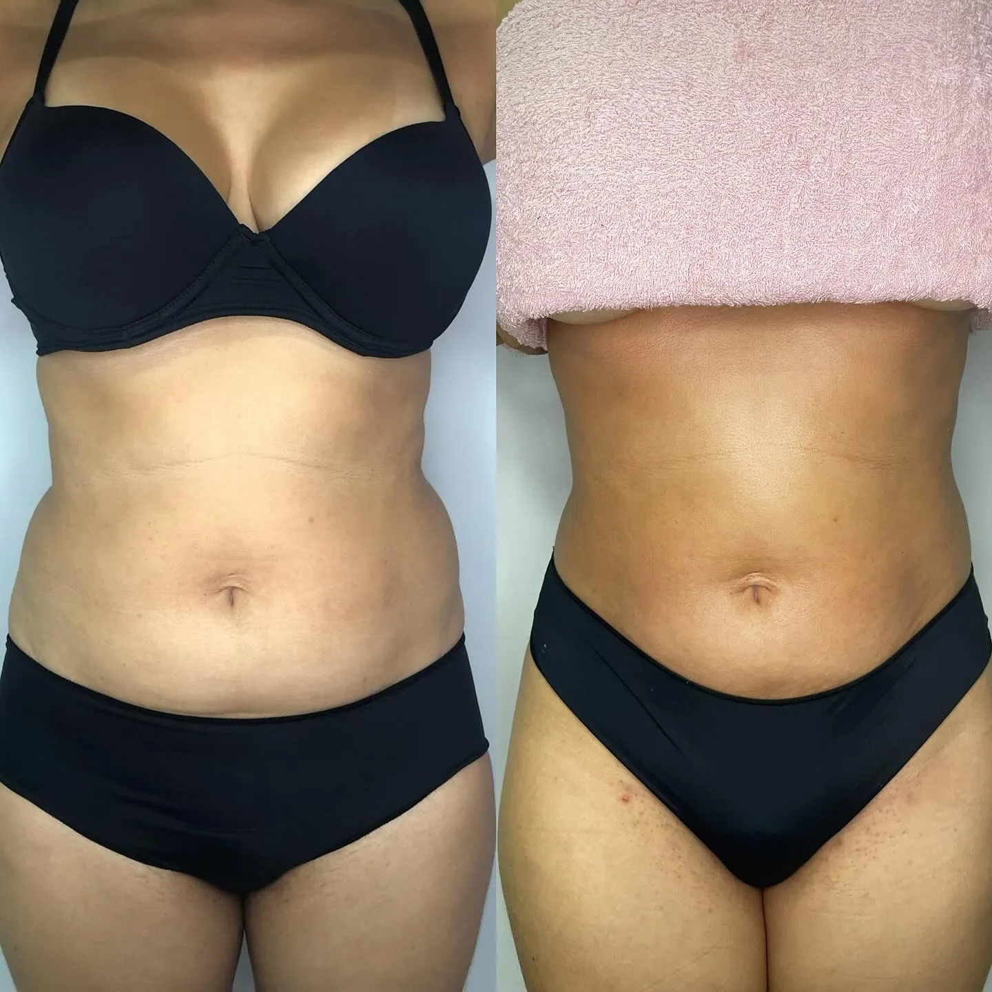 Antes e depois 4.webp